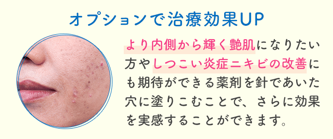 細かい部位までアプローチ可能