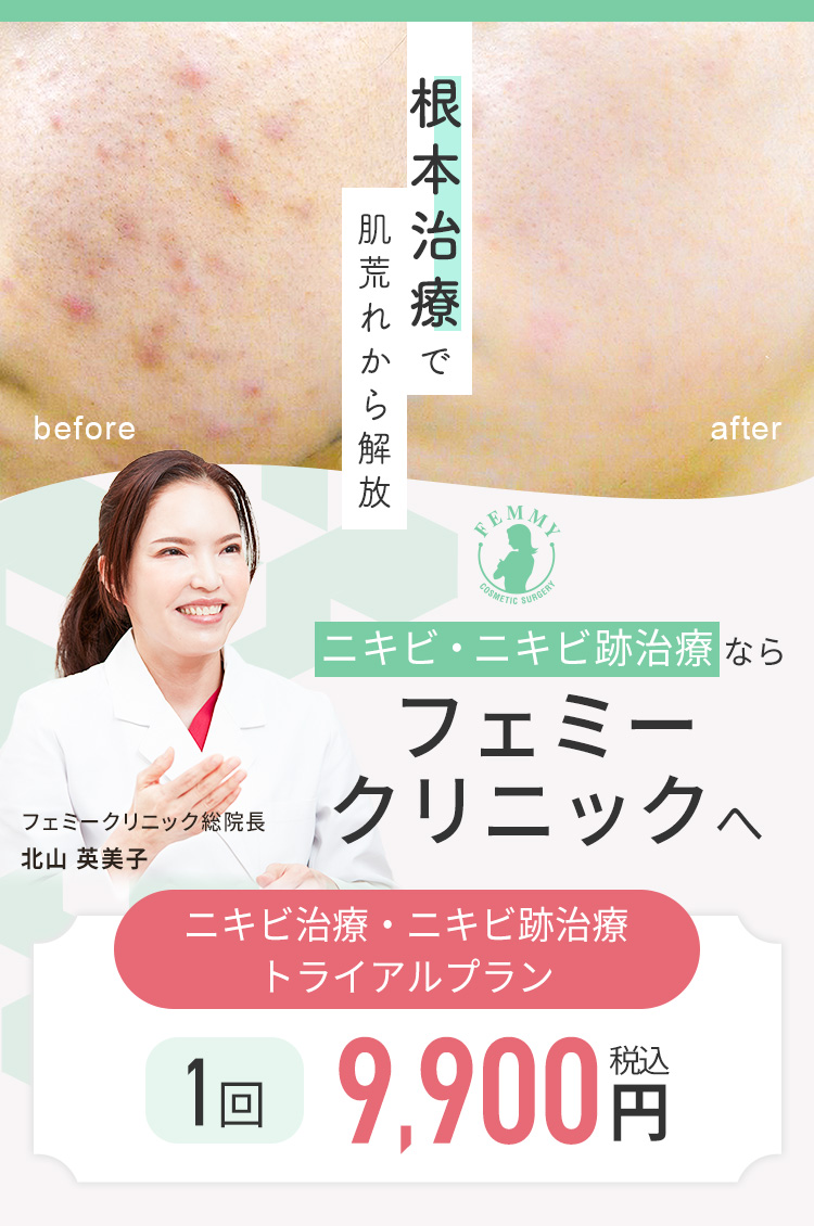 根本治療で肌荒れから解放 ニキビ・ニキビ跡治療ならフェミークリニックへ