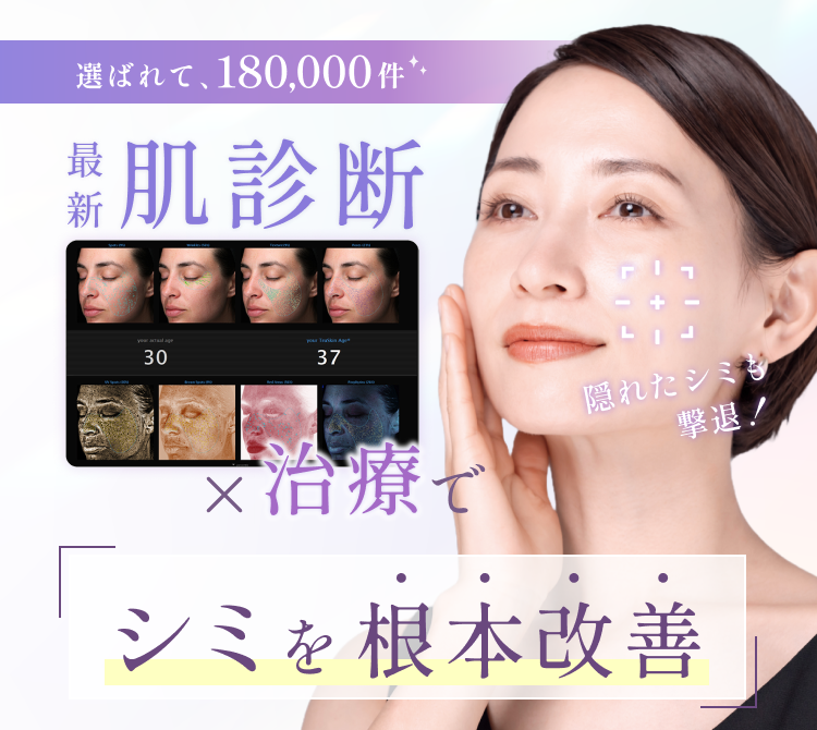 ゴールは シミのない透明美肌