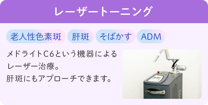 レーザートーニング
