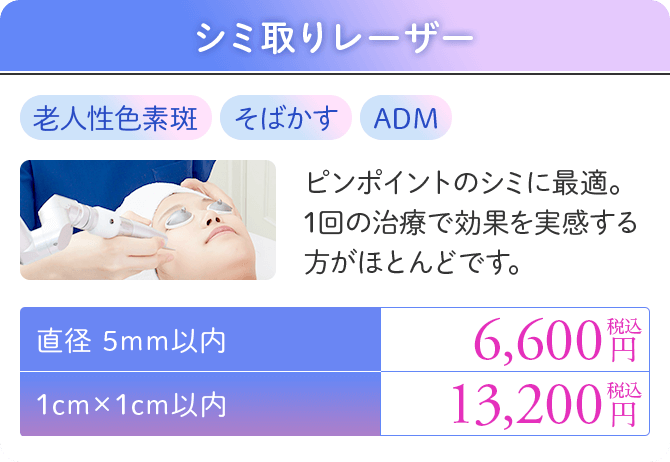 シミ取りレーザー