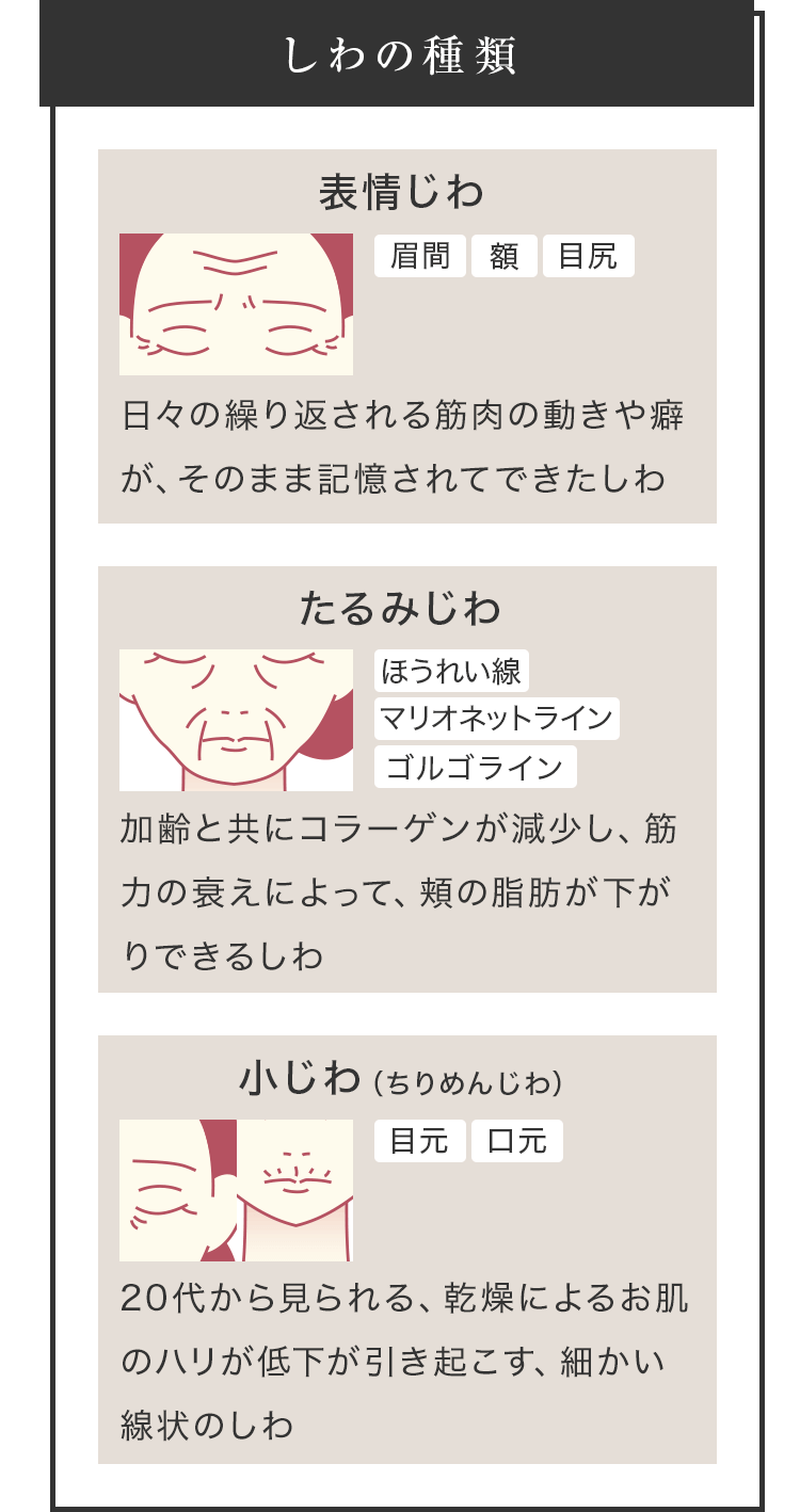 しわの種類